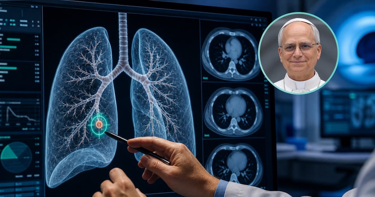 Nódulo pulmonar: la lesión de tres milímetros que obliga a pasar por el quirófano