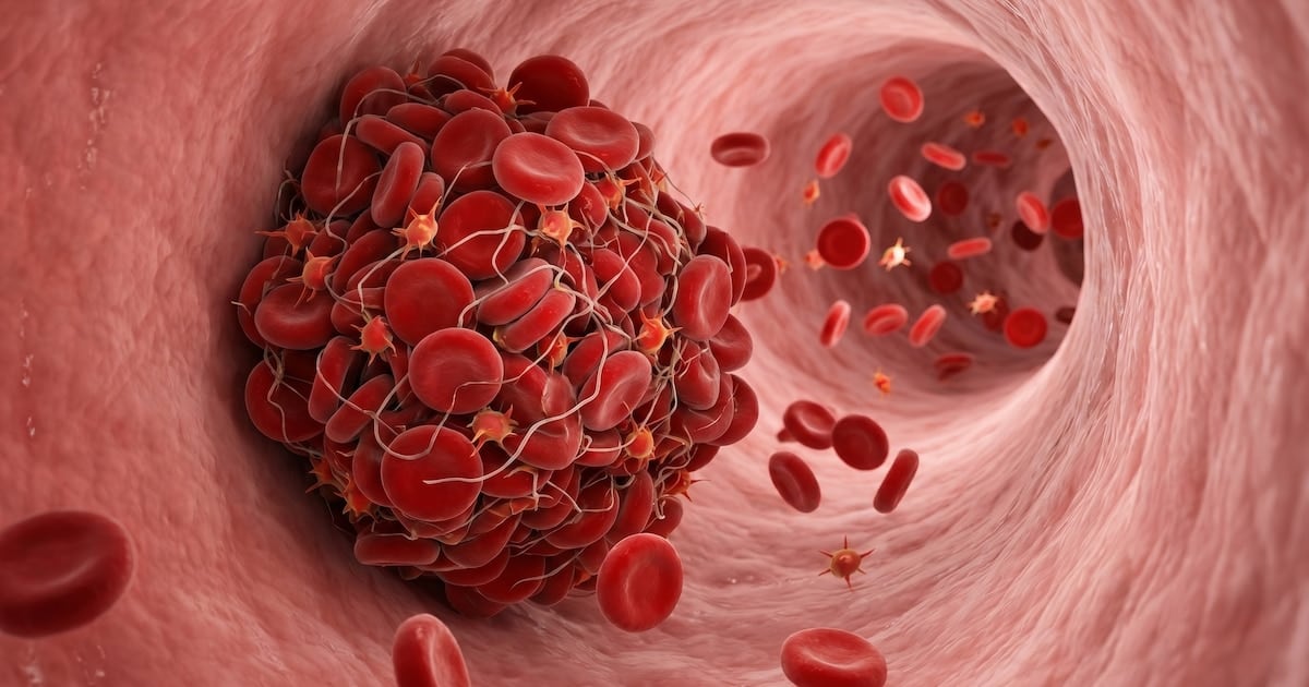 Coágulos en las venas: cómo reconocer las señales a tiempo y por qué a veces el cuerpo avisa antes de la emergencia