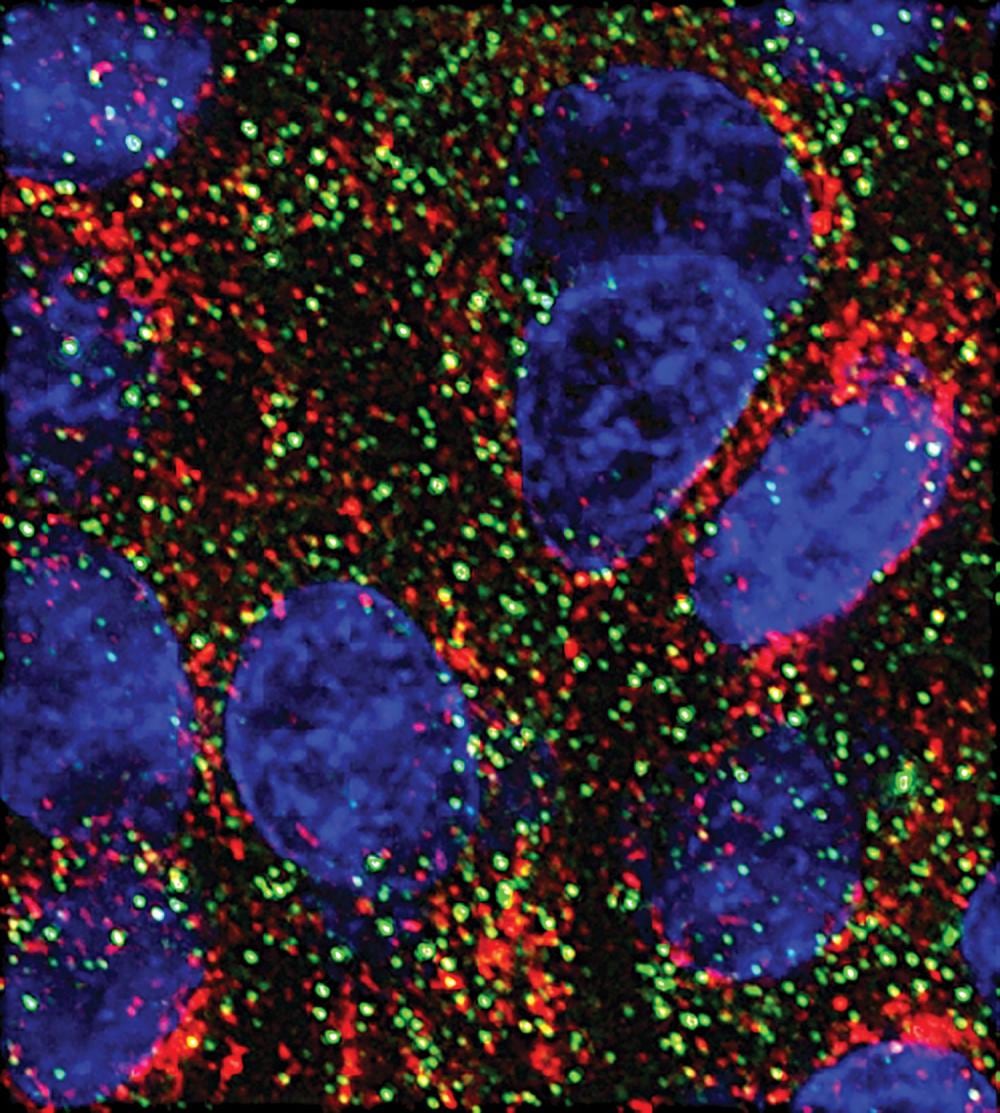 MicroARN muestran capacidad de frenar el crecimiento de células pancreáticas en laboratorio